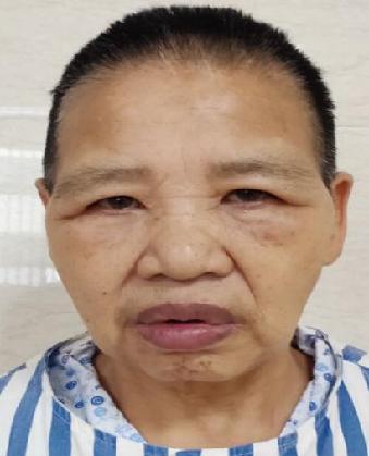 走失者照片 全国救助站
