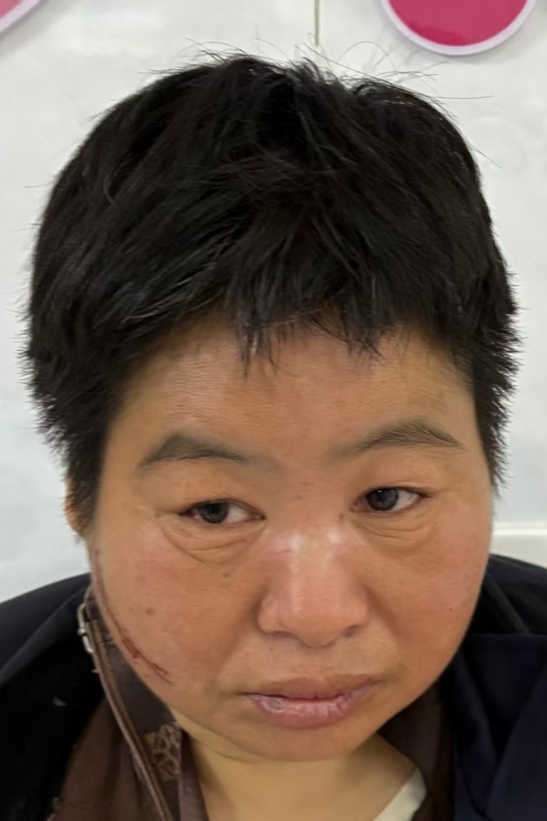 走失者照片 全国救助站
