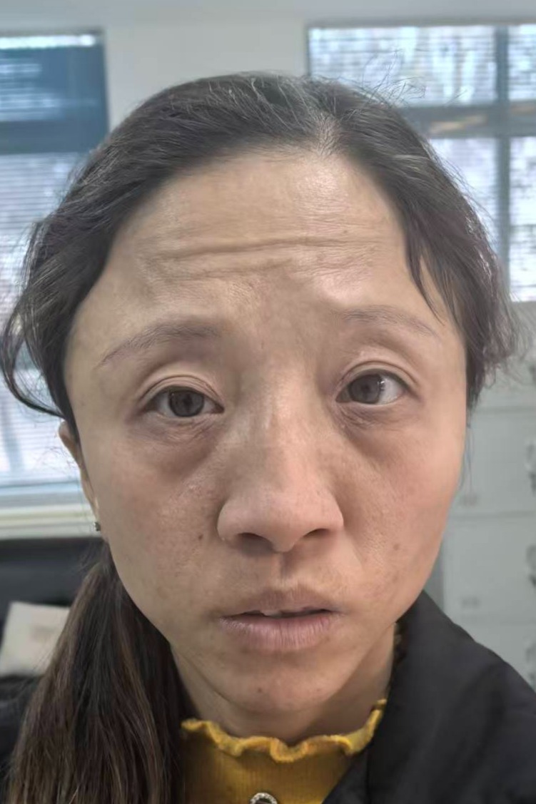 走失者照片 全国救助站