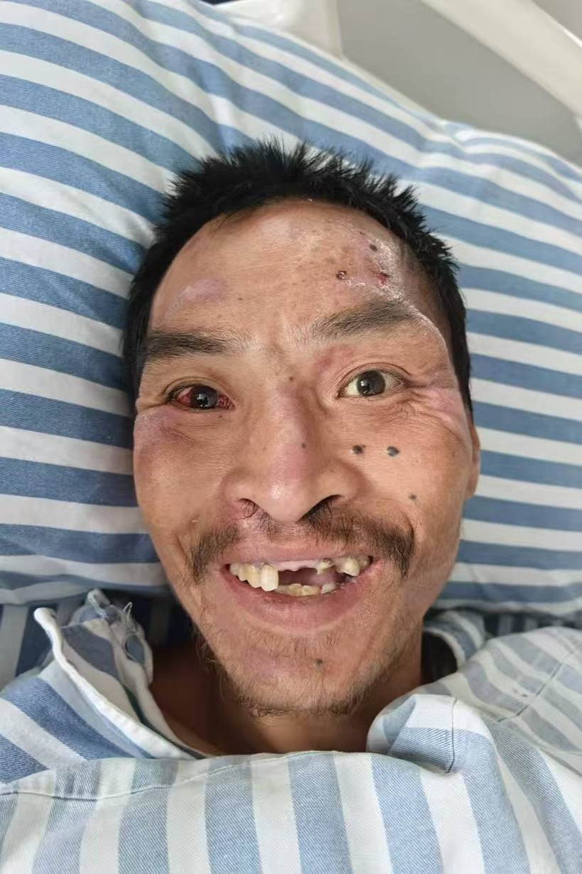 走失者照片 全国救助站