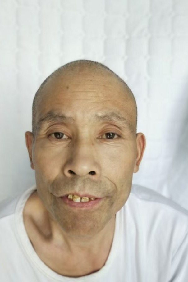 走失者照片 全国救助站