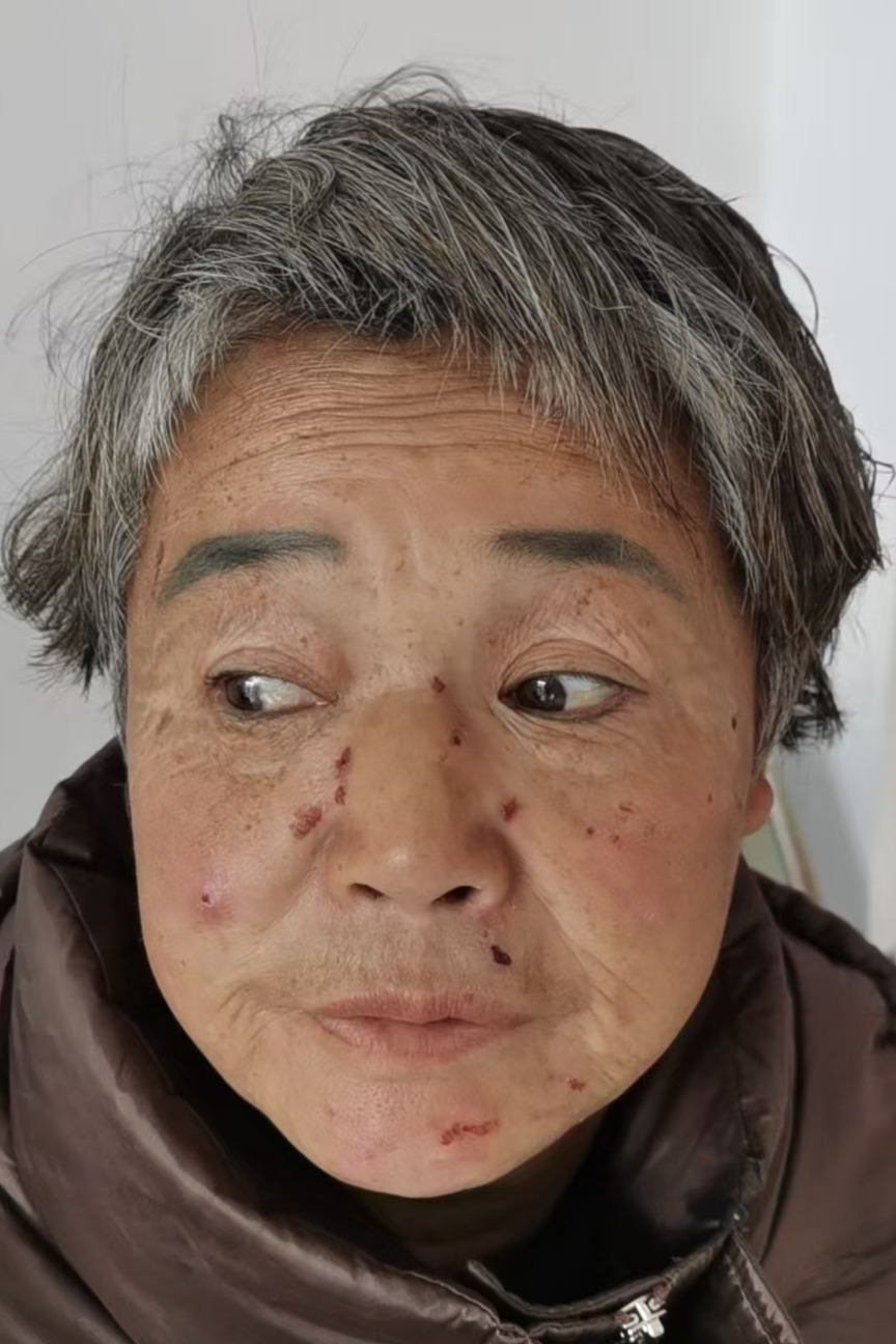走失者照片 全国救助站