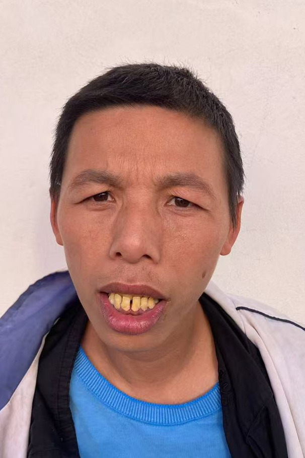 走失者照片 全国救助站