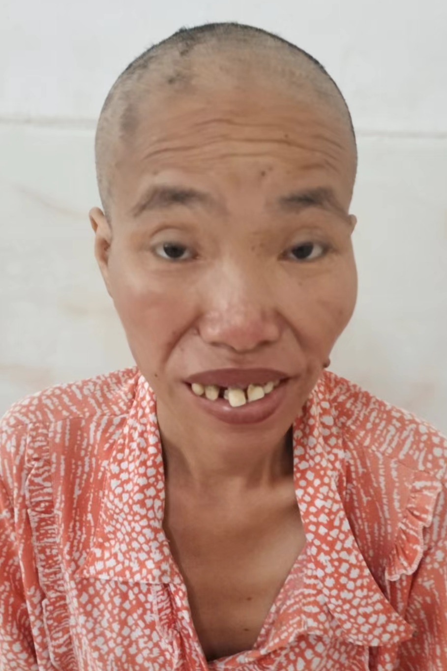 走失者照片 全国救助站