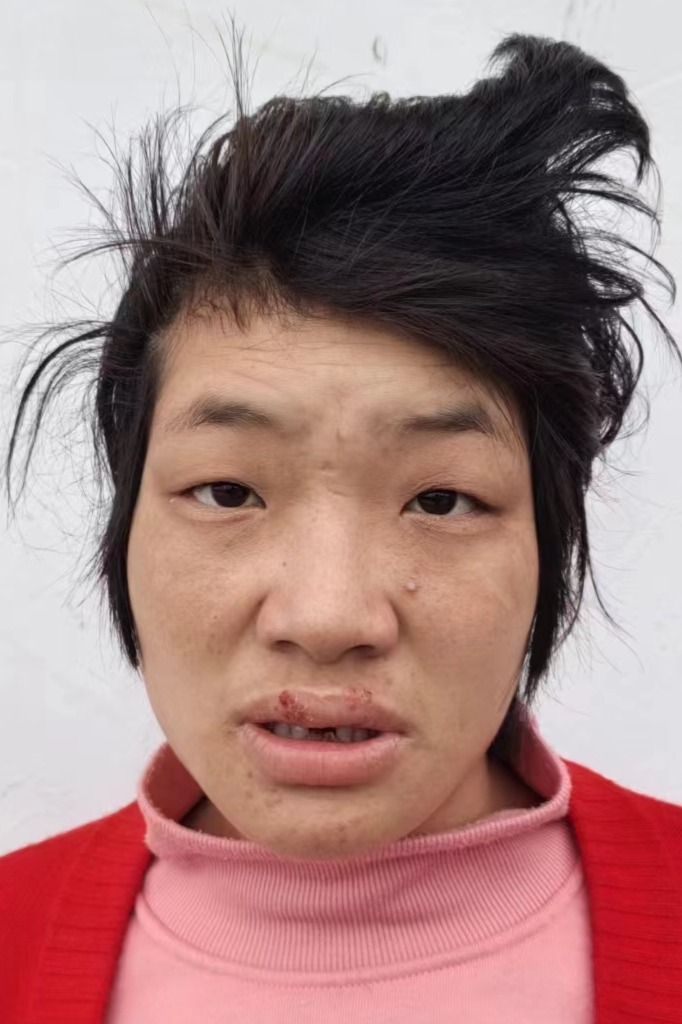 走失者照片 全国救助站