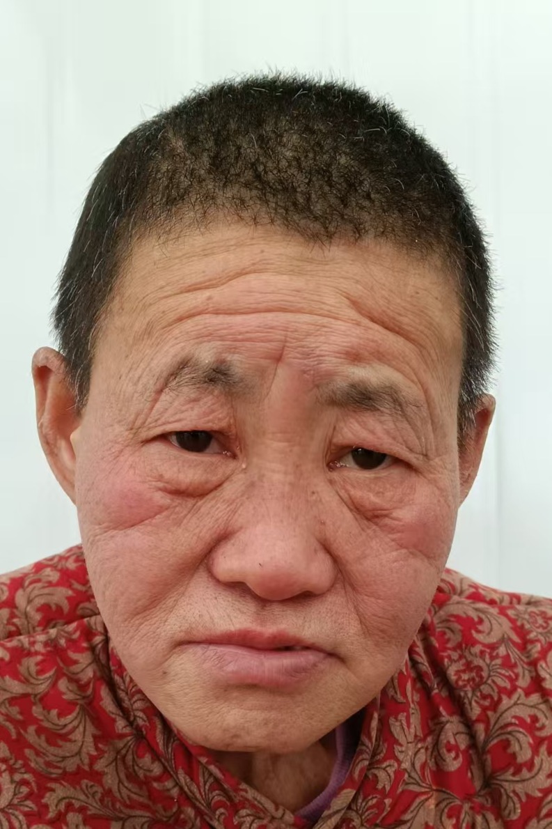 走失者照片 全国救助站