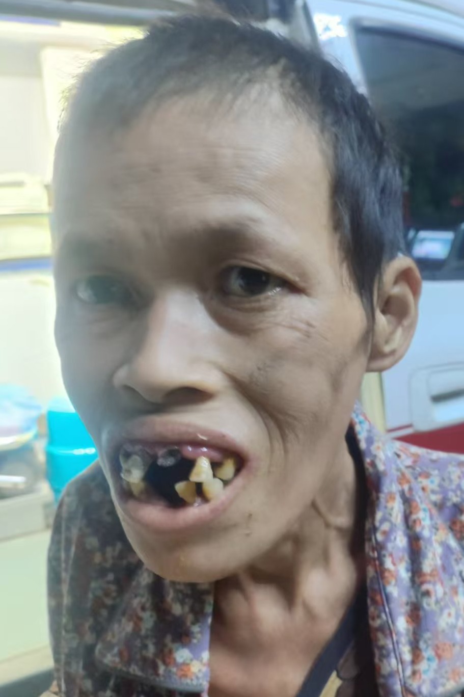 走失者照片 全国救助站