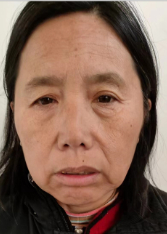 走失者照片 全国救助站