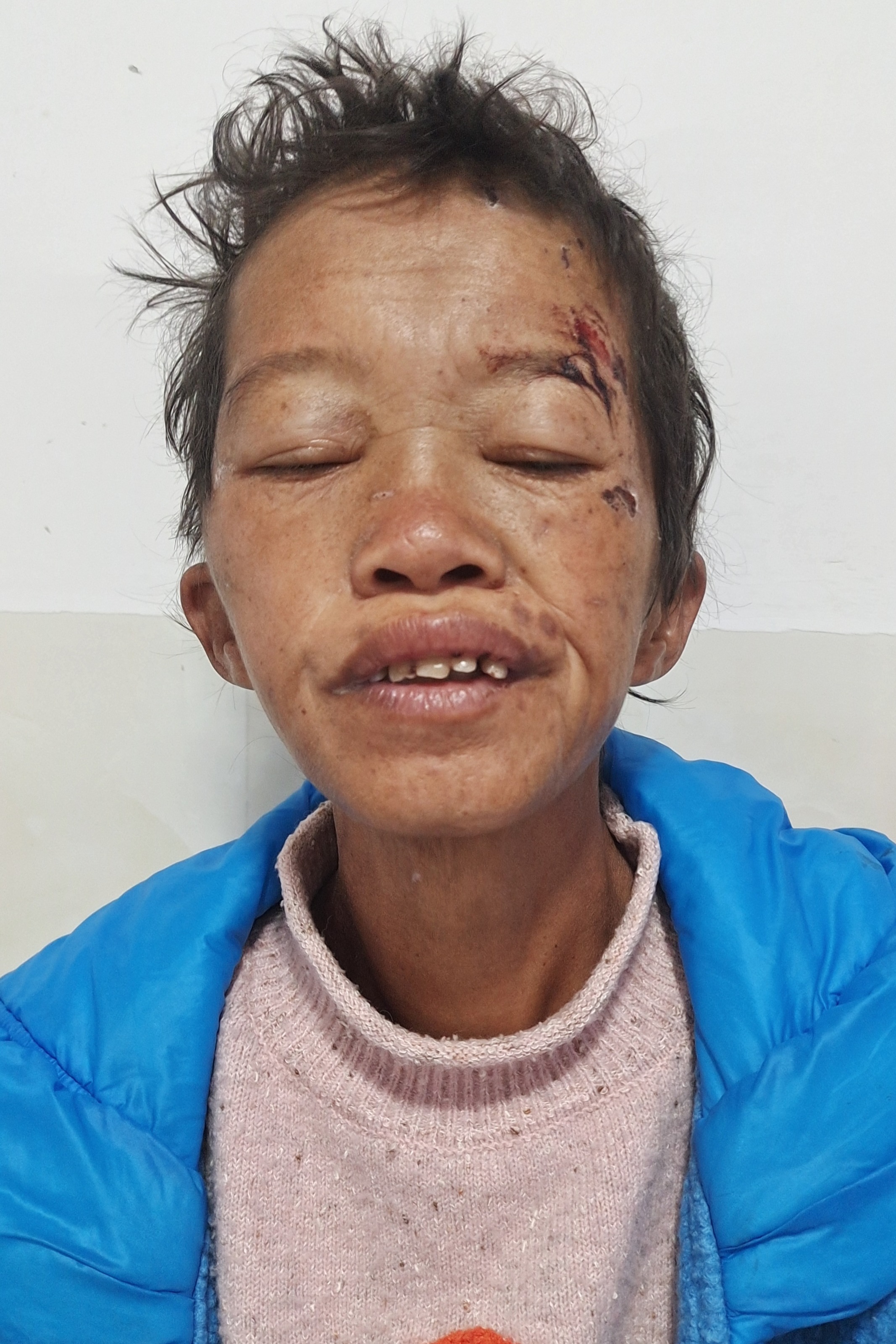 走失者照片 全国救助站