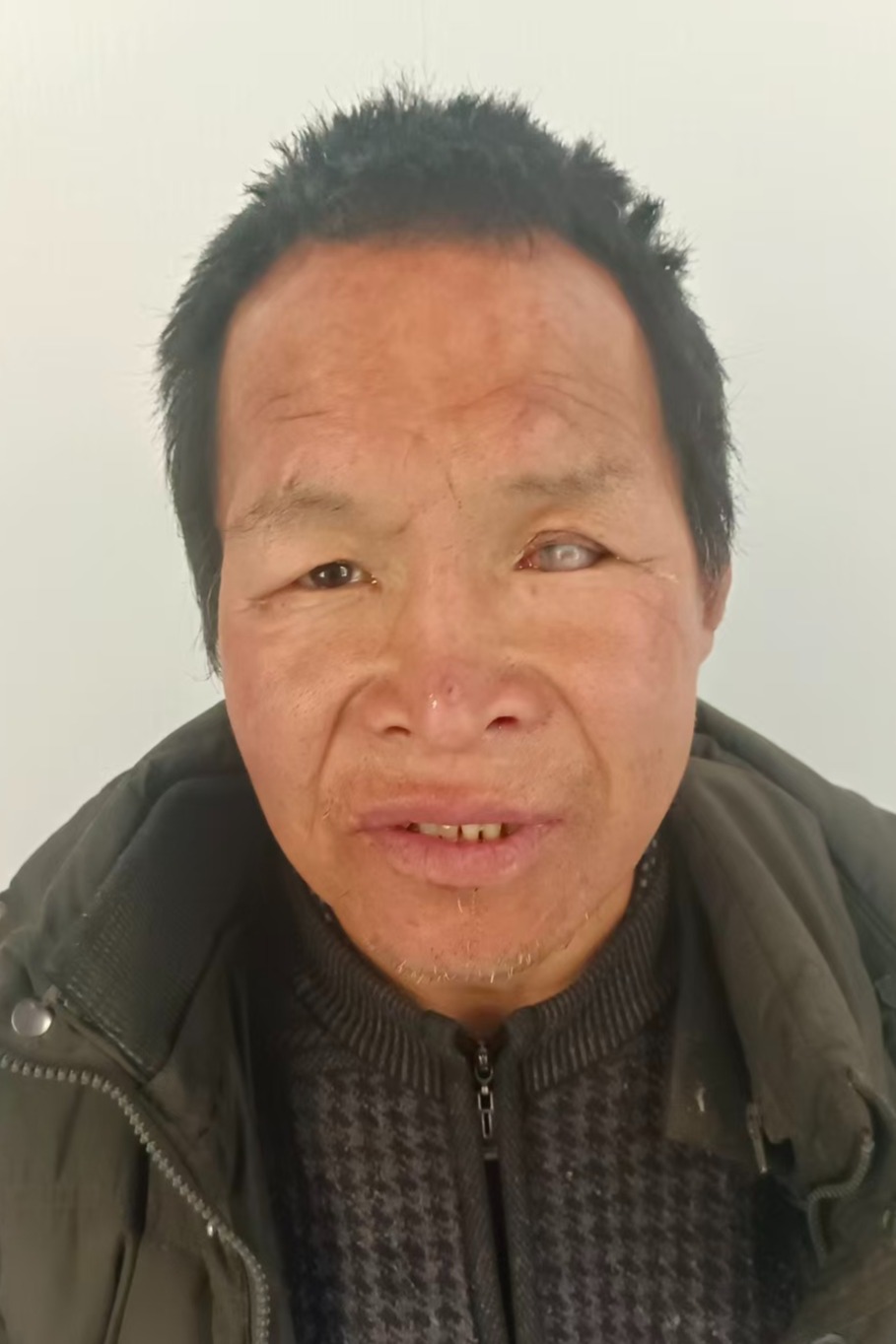 走失者照片 全国救助站