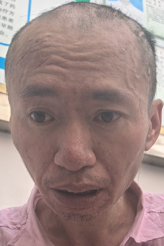 走失者照片 全国救助站