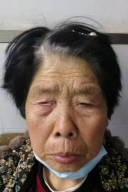 走失者照片 全国救助站