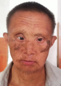 走失者照片 全国救助站