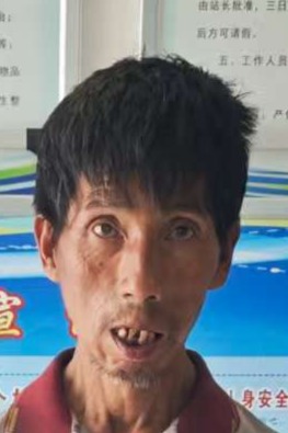 走失者照片 全国救助站