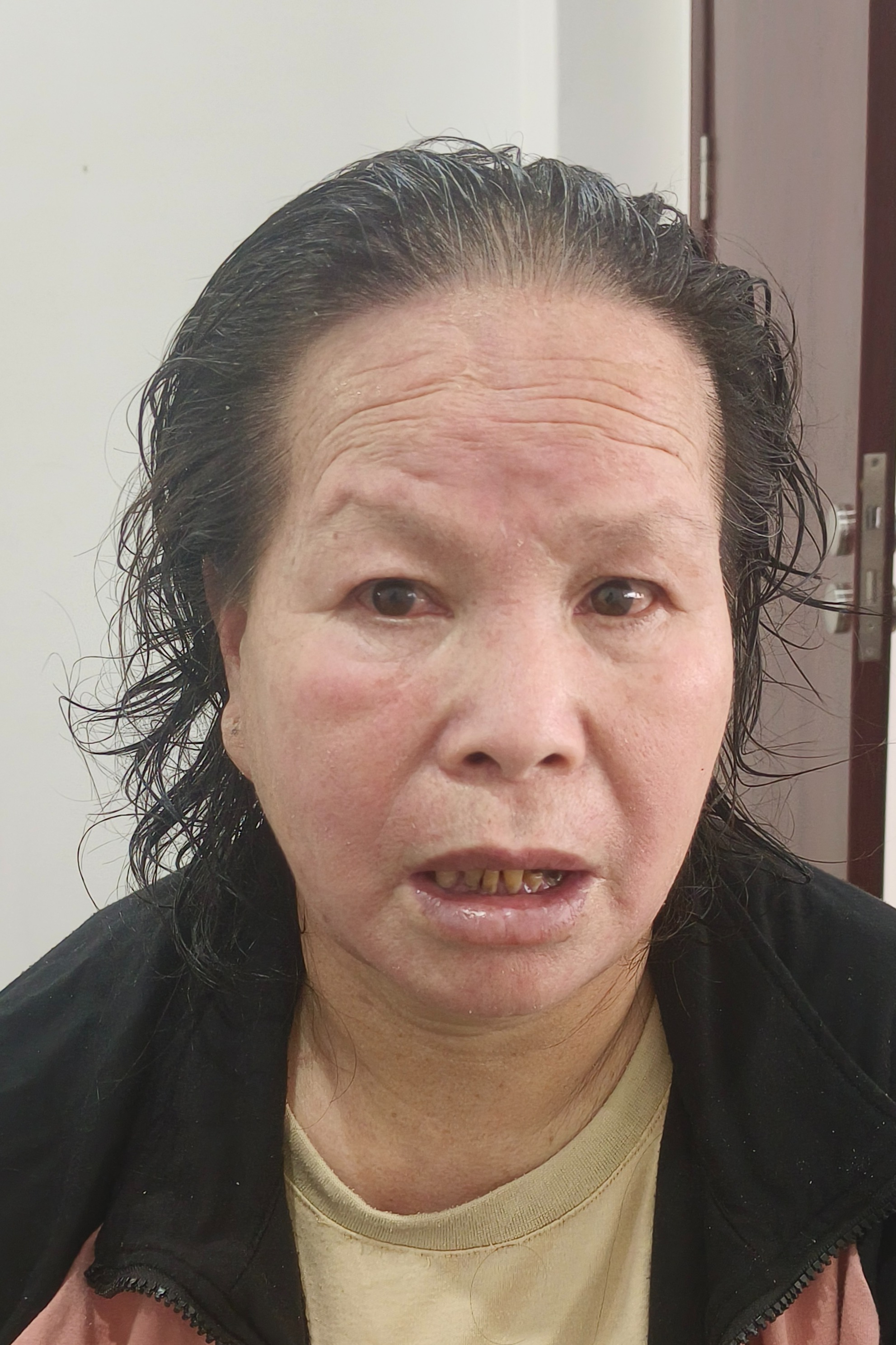 走失者照片 全国救助站
