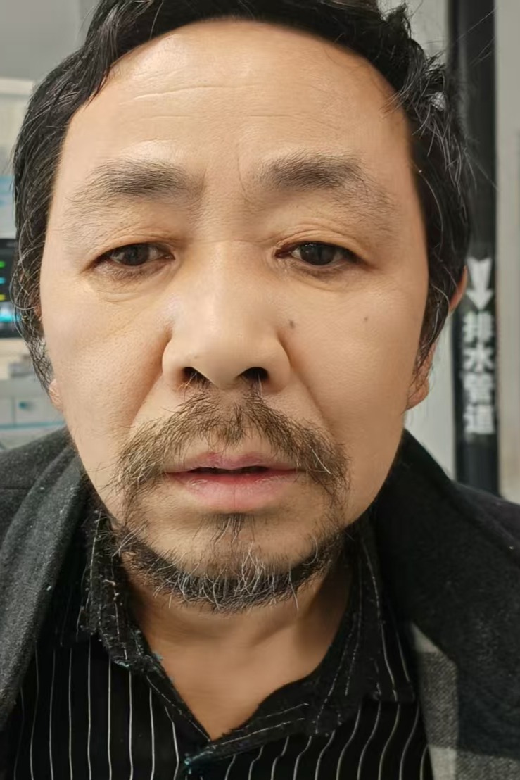 走失者照片 全国救助站
