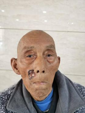 走失者照片 荆州市寻亲：九旬老人被救助，自述叫...