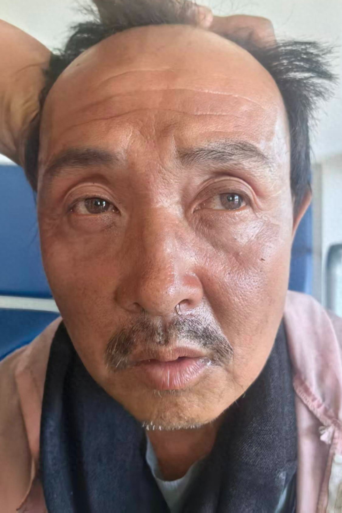 走失者照片 大连市瓦房店市寻亲：五旬男子被救助...