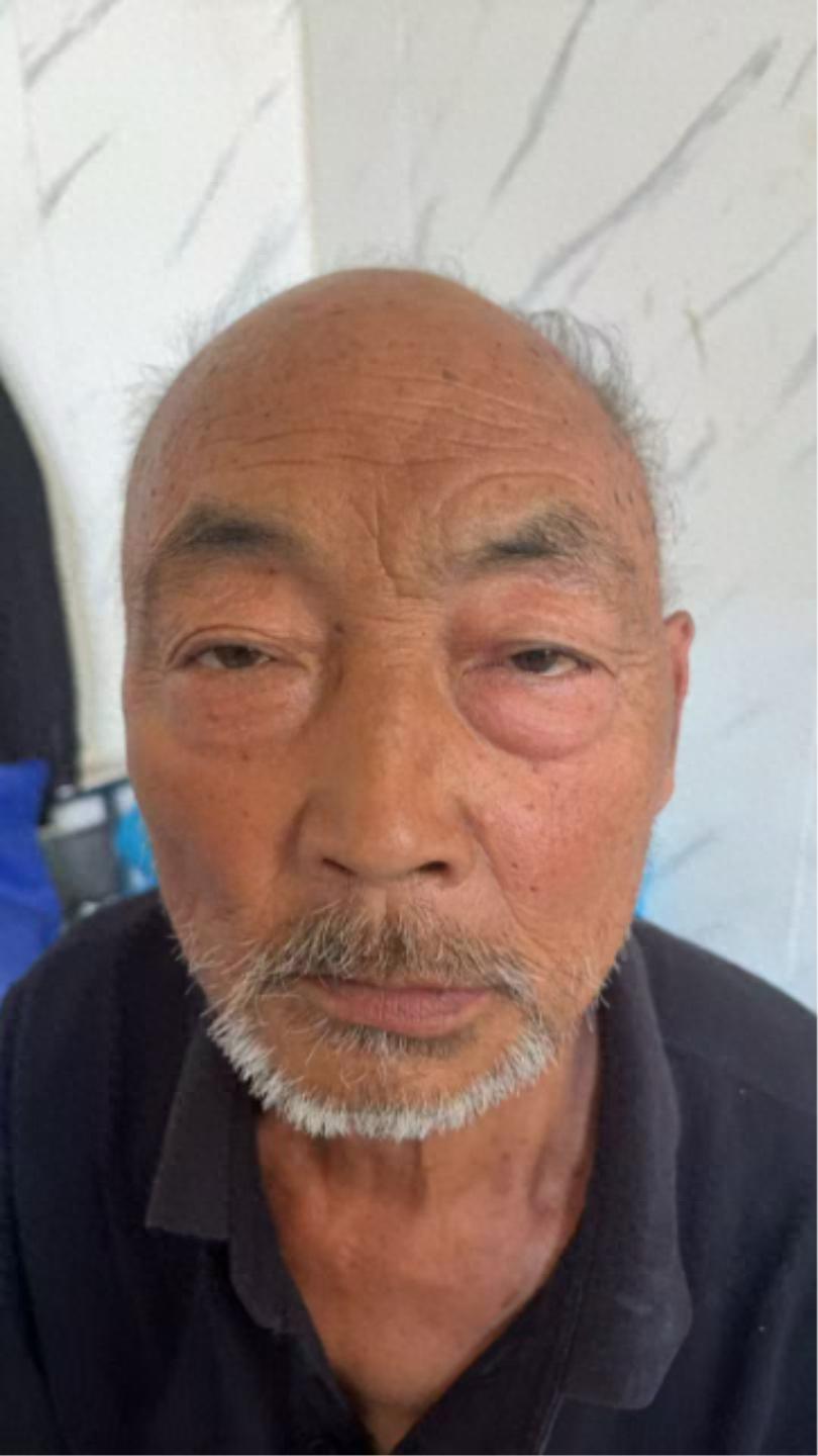 走失者照片 西安市寻亲：七旬老人被救助，自述名...