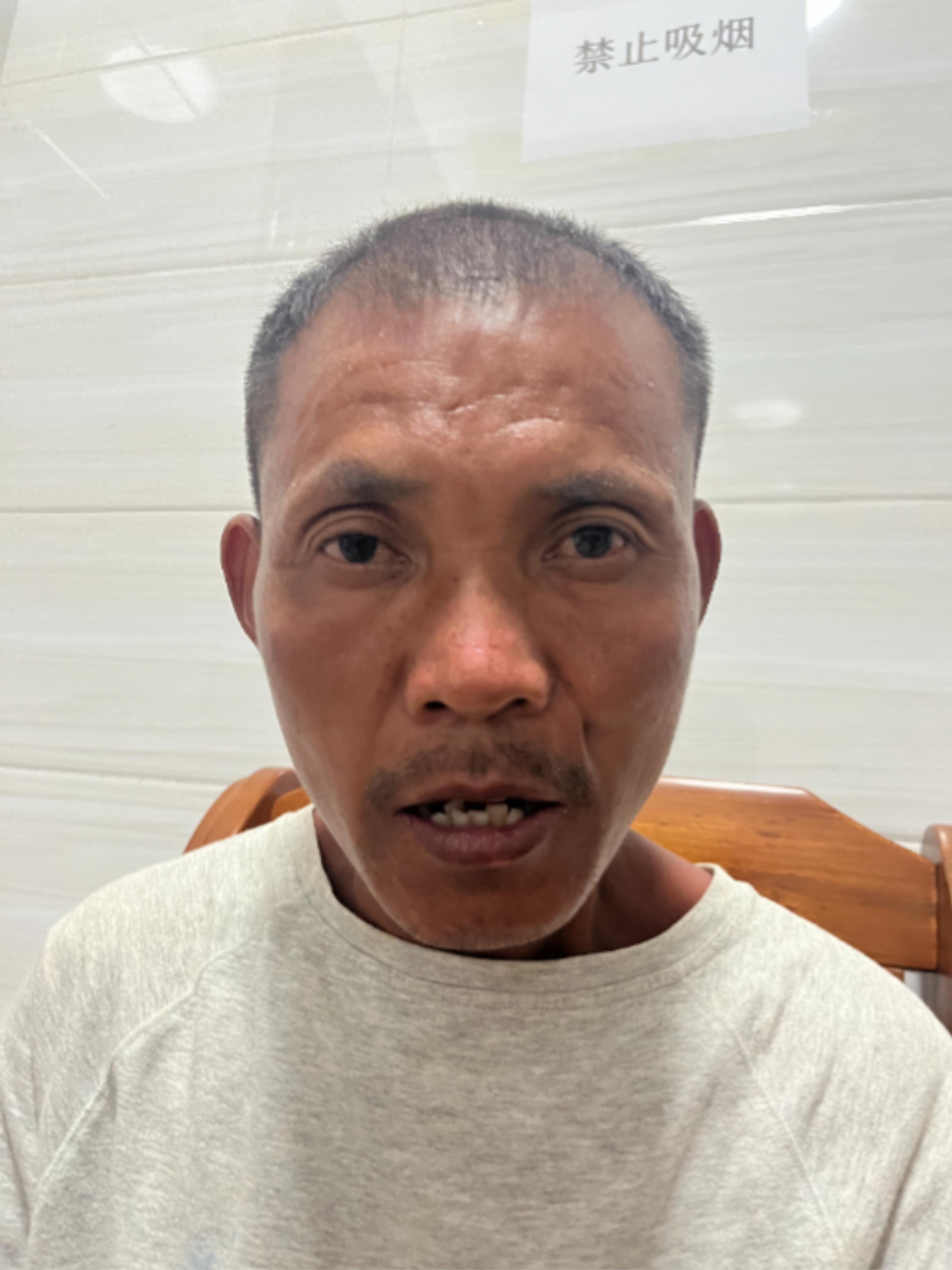 走失者照片 衡阳市寻亲：中年男子被救助，疑似精...