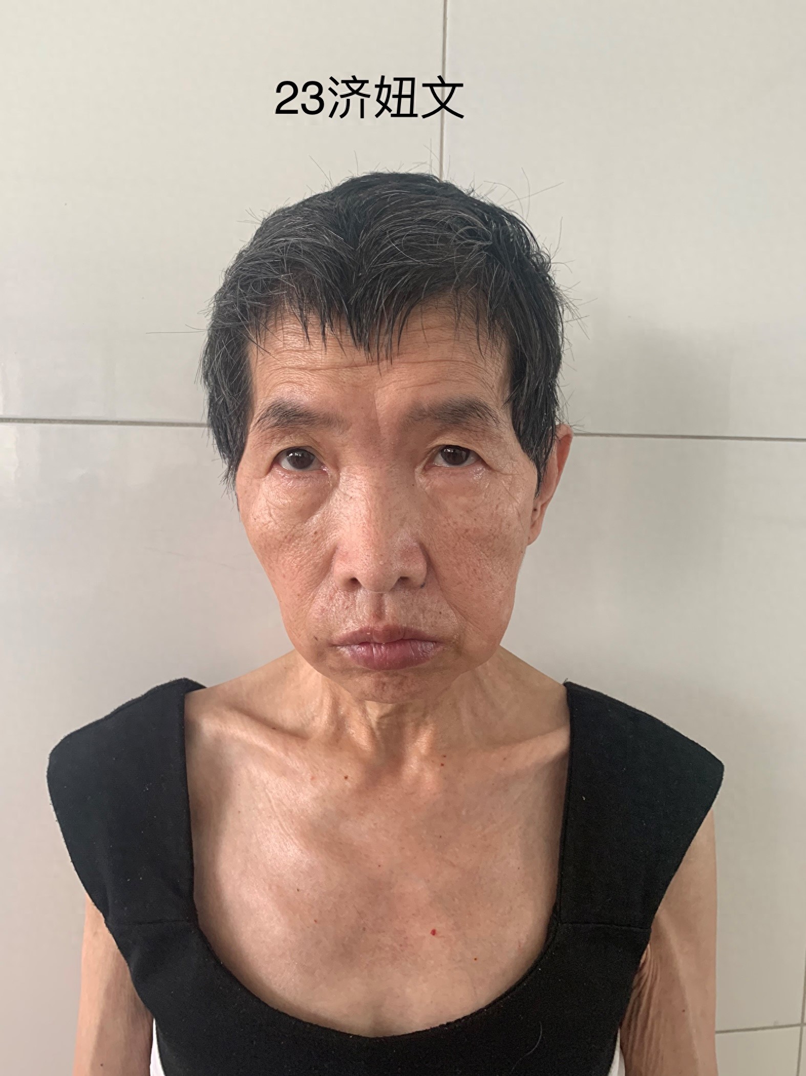 走失者照片 济南市寻亲：中年女子被救助，单眼皮...