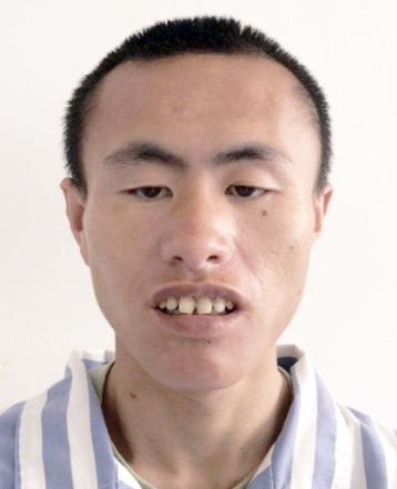 走失者照片 北京市寻亲：青年男子被救助，疑患智...