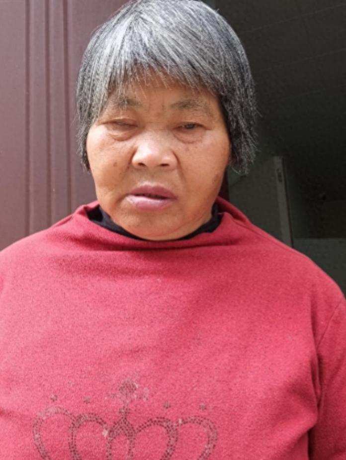 走失者照片 泉州市寻亲：六旬老太被救助，右眼患...