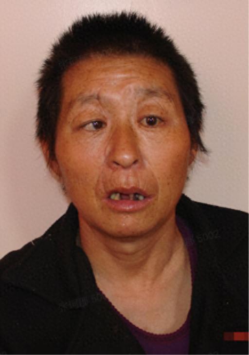 走失者照片 晋中市寻亲：五旬女子被救助，眼睛斜...