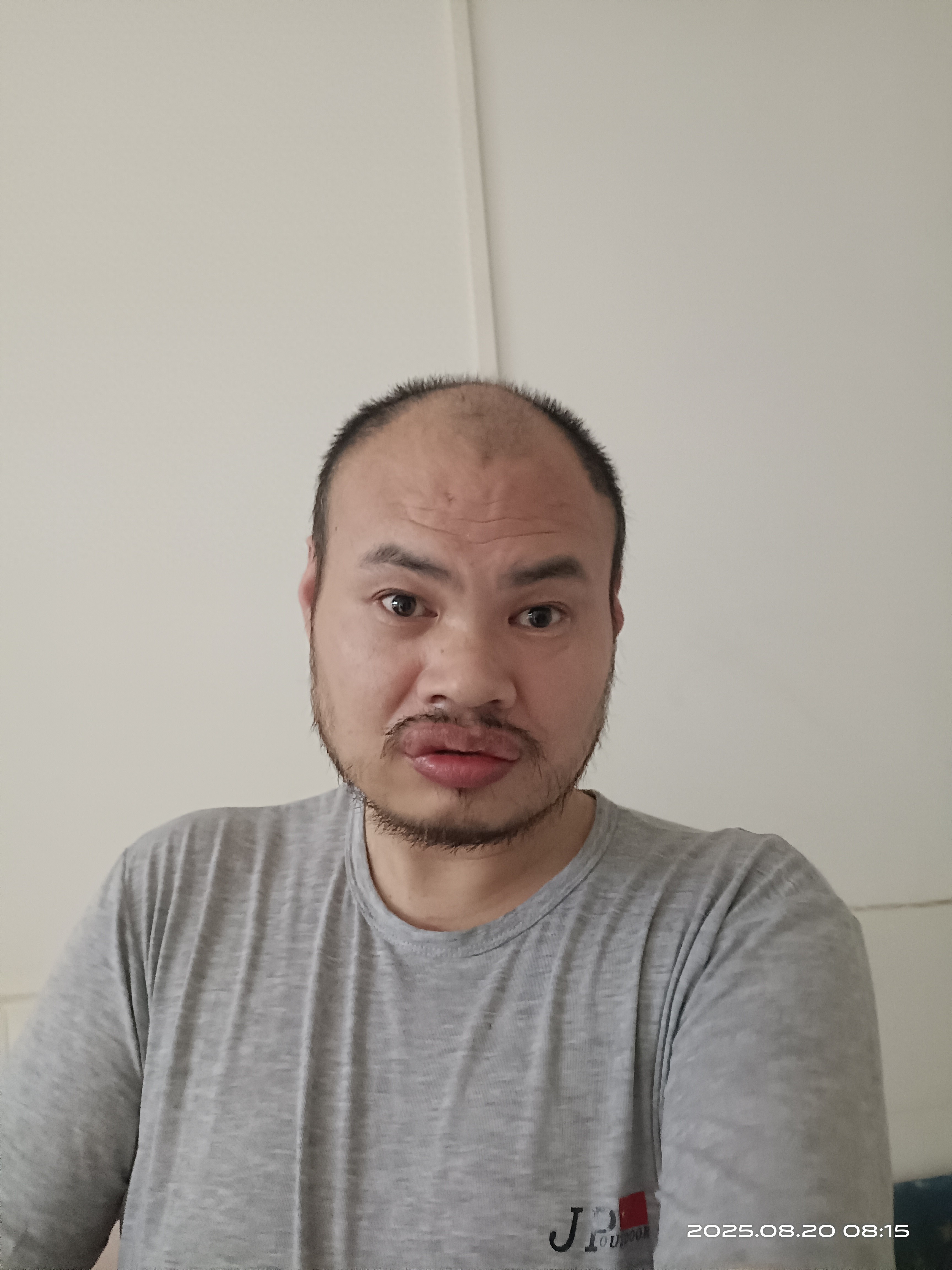 走失者照片 邵阳市寻亲：中年男子被救助，高1米...