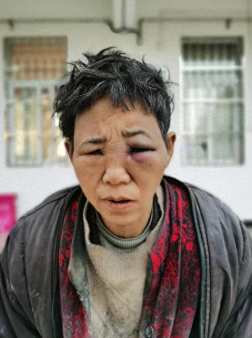 走失者照片 许昌市寻亲：五旬女子被救助，自述叫...