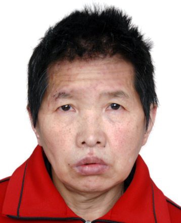 走失者照片 济南市寻亲：中年女子被救助，单眼皮...