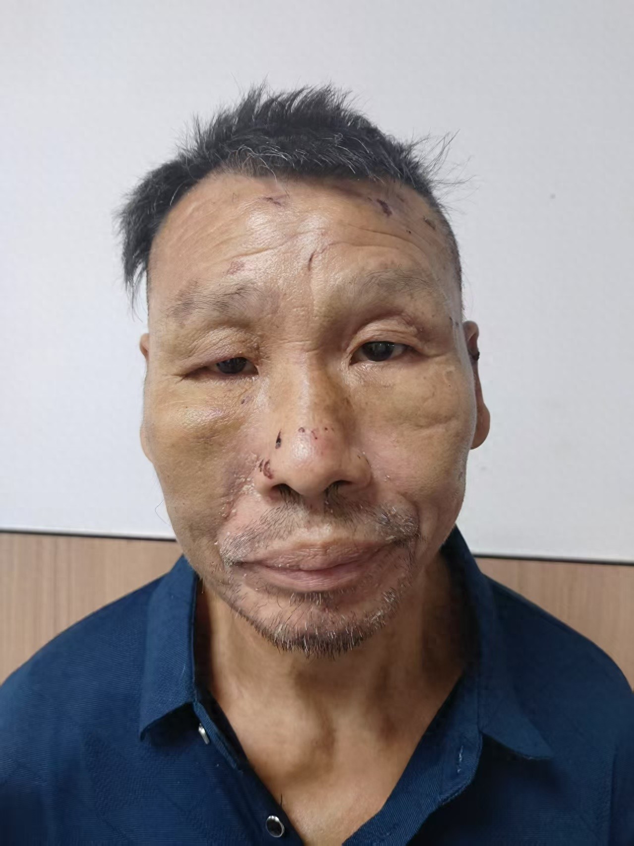 走失者照片 淮北市寻亲：五旬男子被救助，高约1...