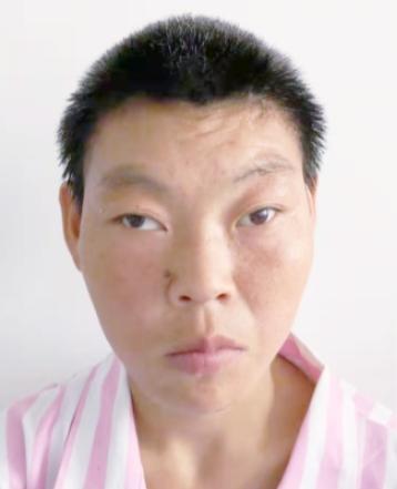 走失者照片 北京市寻亲：青年女子被救助，疑患智...