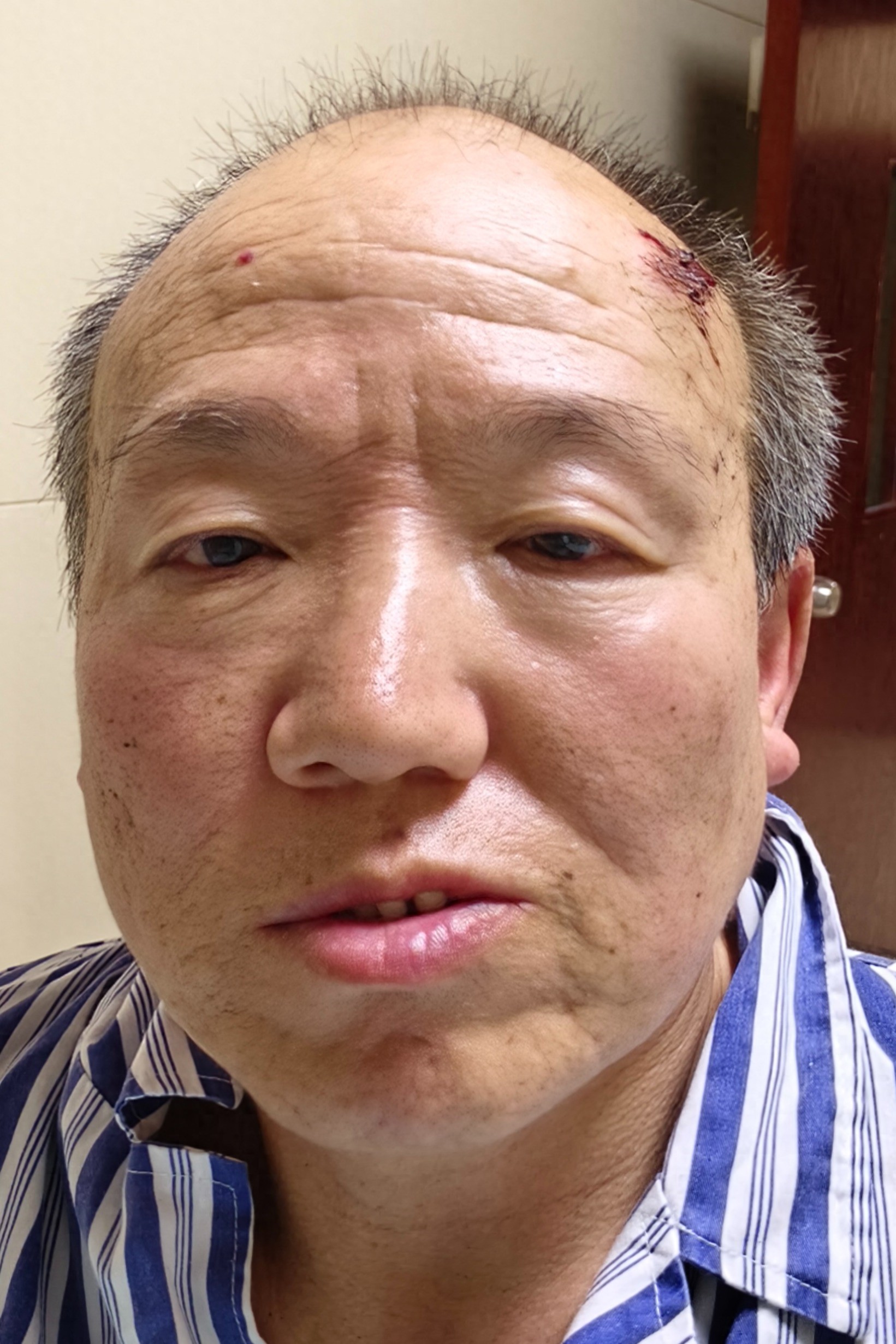走失者照片 桂林市寻亲：五旬男子被救助，自述叫...