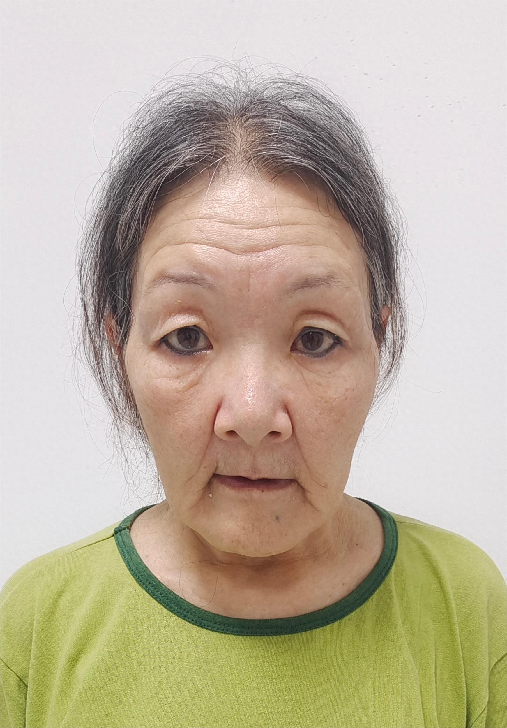 走失者照片 汕尾市陆丰市寻亲：六旬老太被救助，...