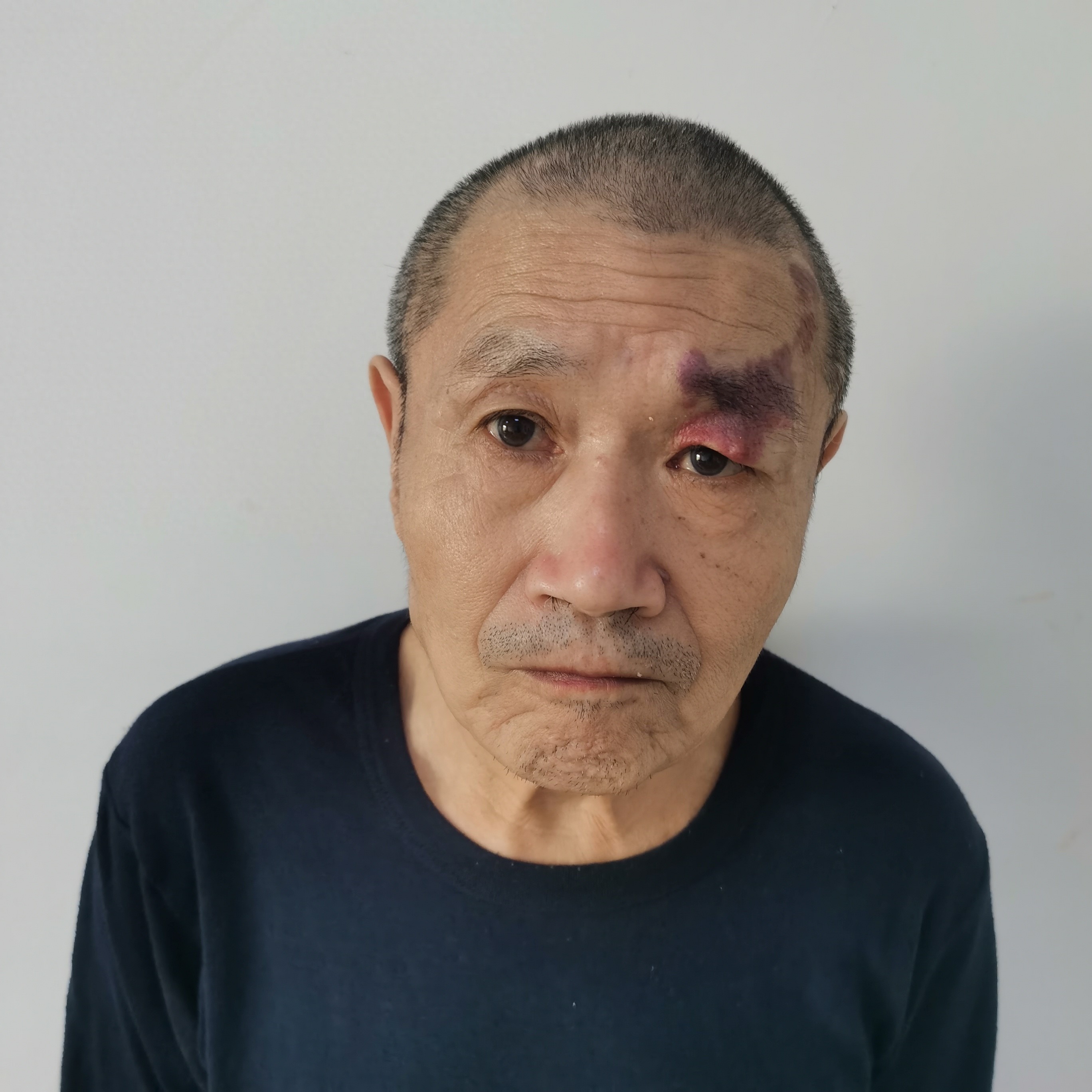 走失者照片 北京市寻亲：五旬聋哑男子被救助，左...