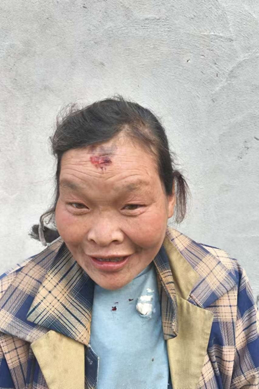 走失者照片 重庆市寻亲：六旬老太被救助，自述叫...