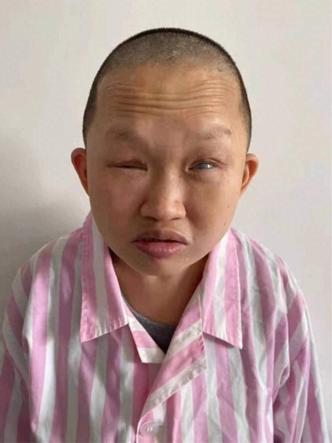 走失者照片 北京市寻亲：青年女子被救助，视力残...