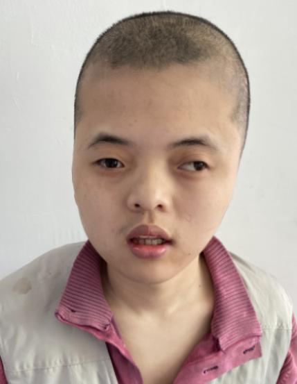 走失者照片 潮州市寻亲：青年男子被救助，高1米...