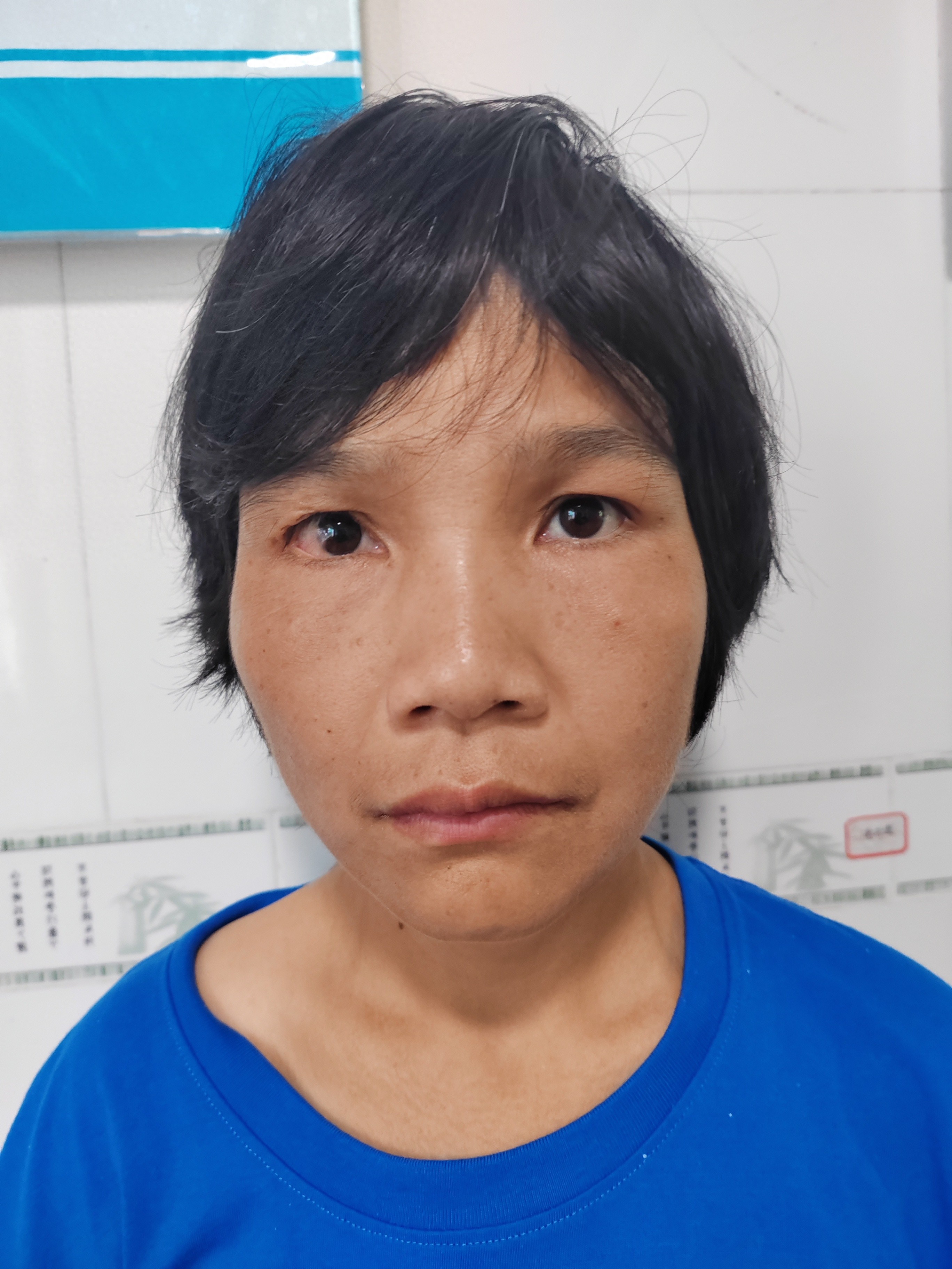 走失者照片 南宁市寻亲：中年女子被救助，自述叫...