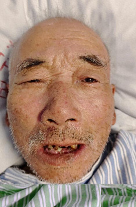 走失者照片 南宁市寻亲：七旬老人被救助，高1米...