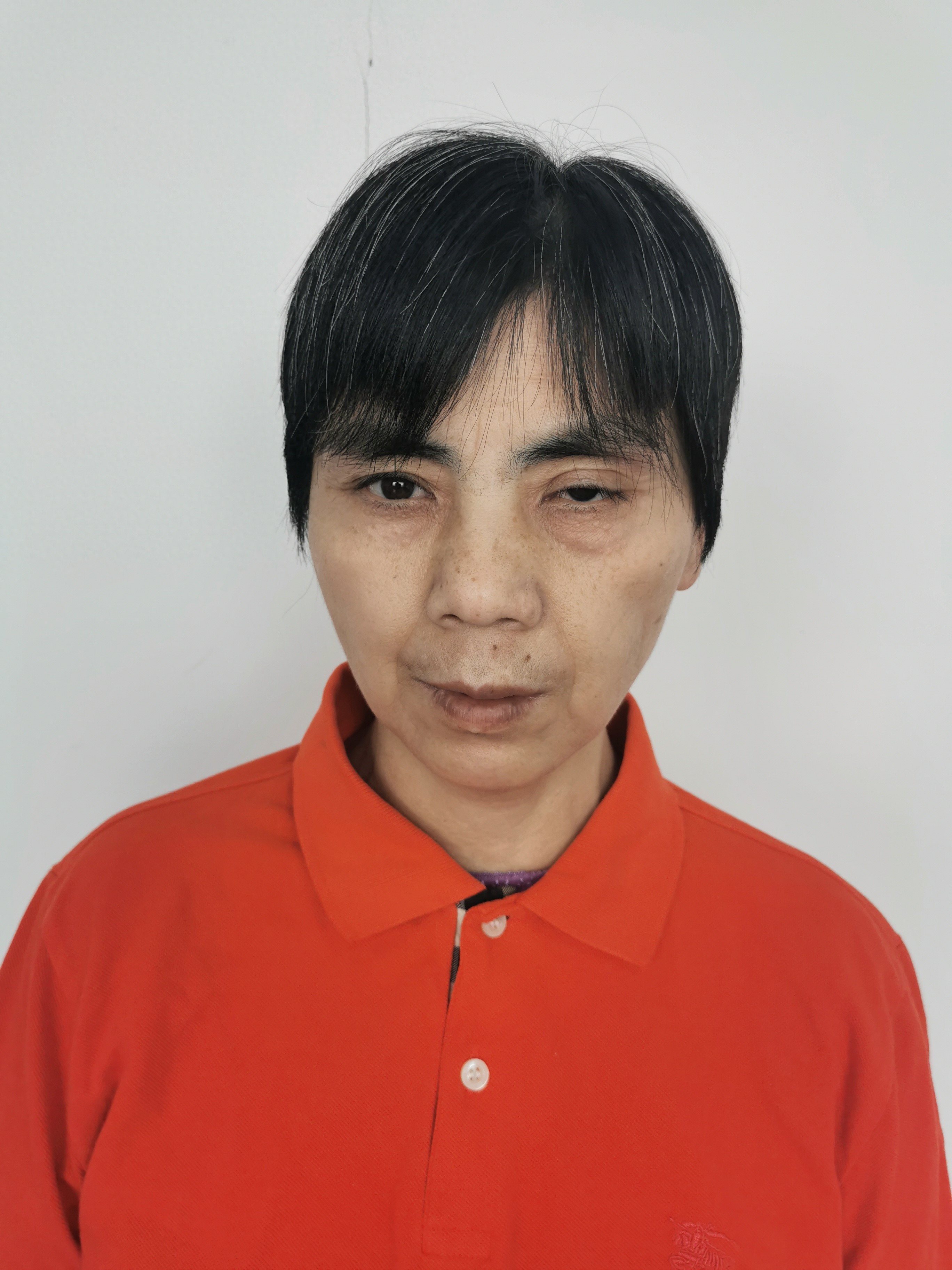 走失者照片 北京市寻亲：青年女子被救助，左肘关...