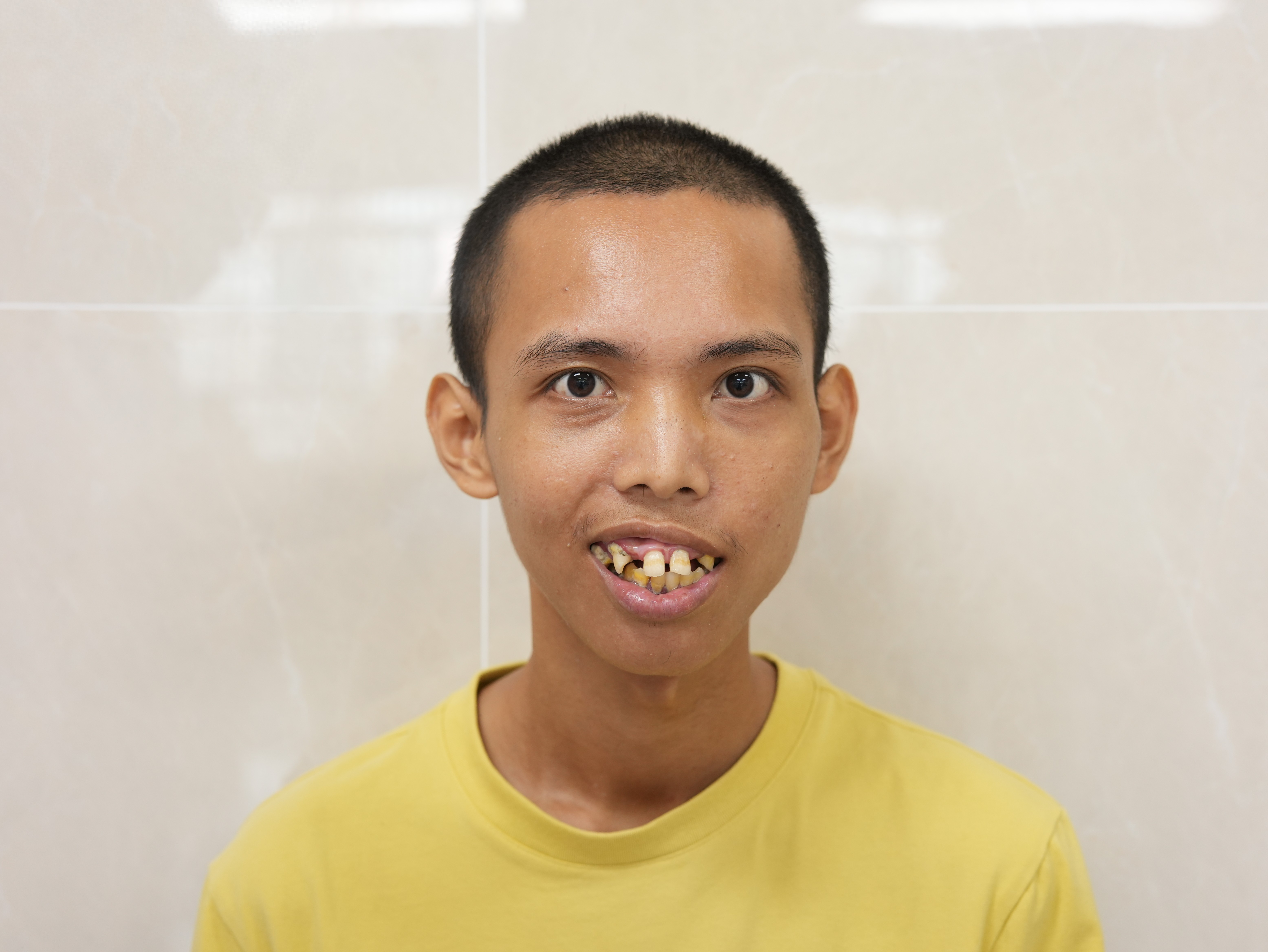 走失者照片 厦门市寻亲：青年男子被救助，自述姓...