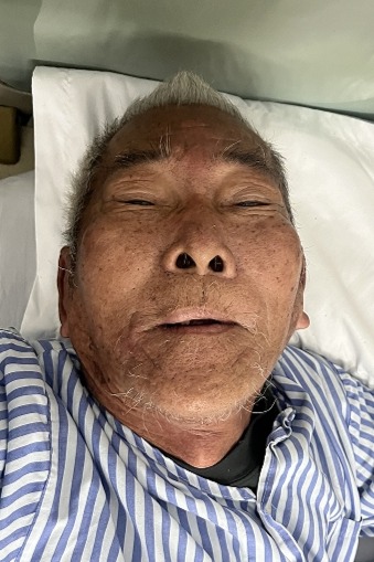 走失者照片 海口市寻亲：八旬老人被救助，自述叫...