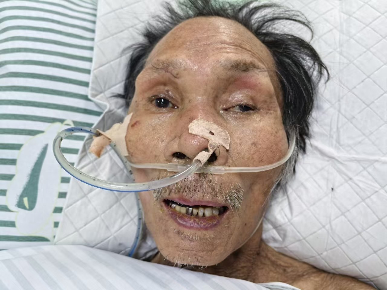 走失者照片 临沂市寻亲：六旬老人被救助，偏瘦，...