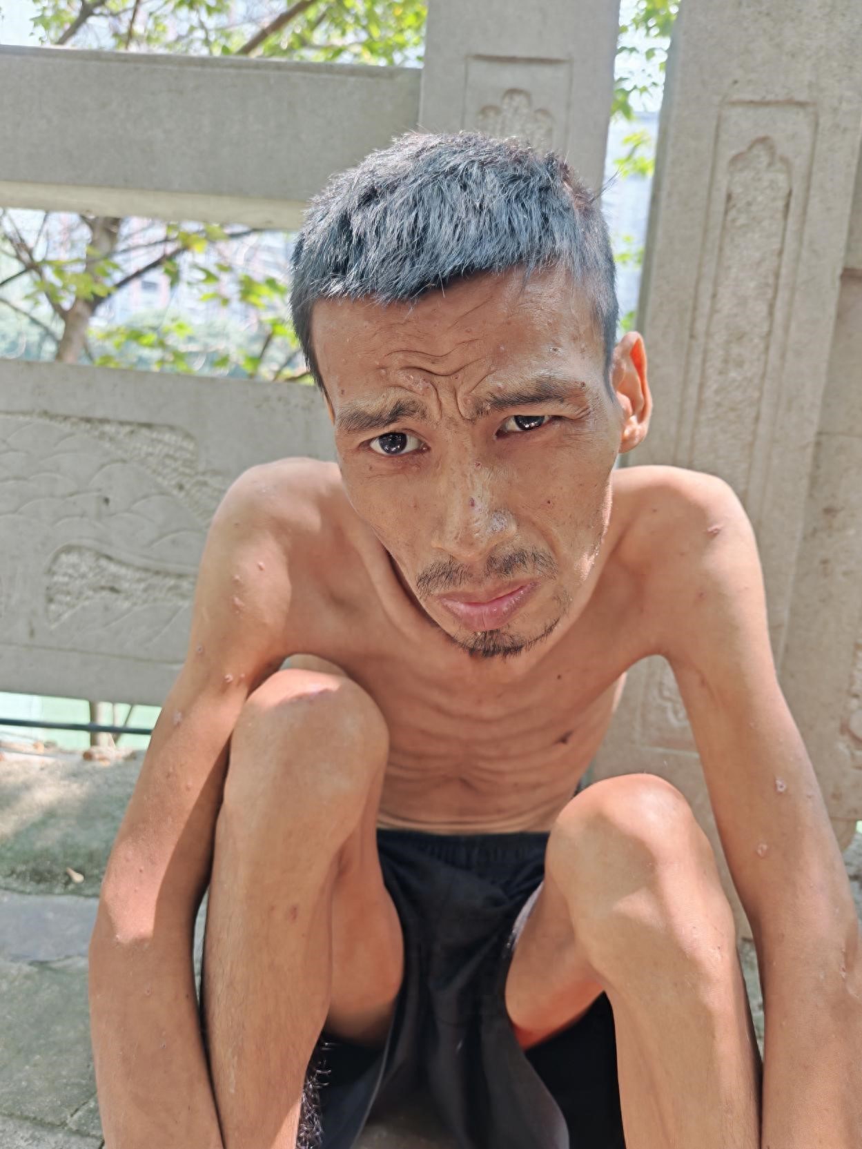 走失者照片 河池市寻亲：青年男子被救助，自述叫...