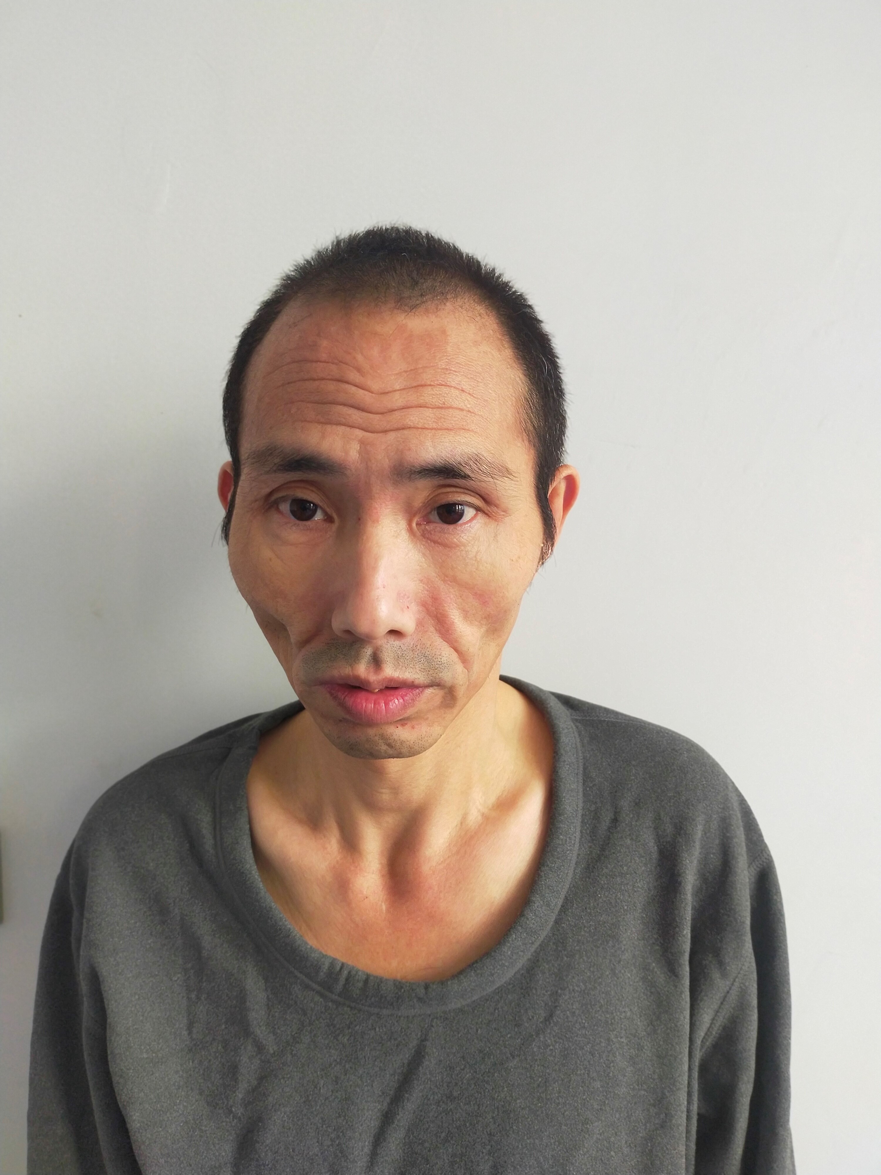 走失者照片 北京市寻亲：青年男子被救助，高1米...
