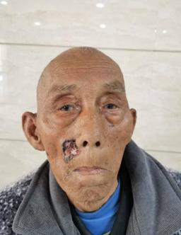 走失者照片 荆州市寻亲：九旬老人因病医治无效身...