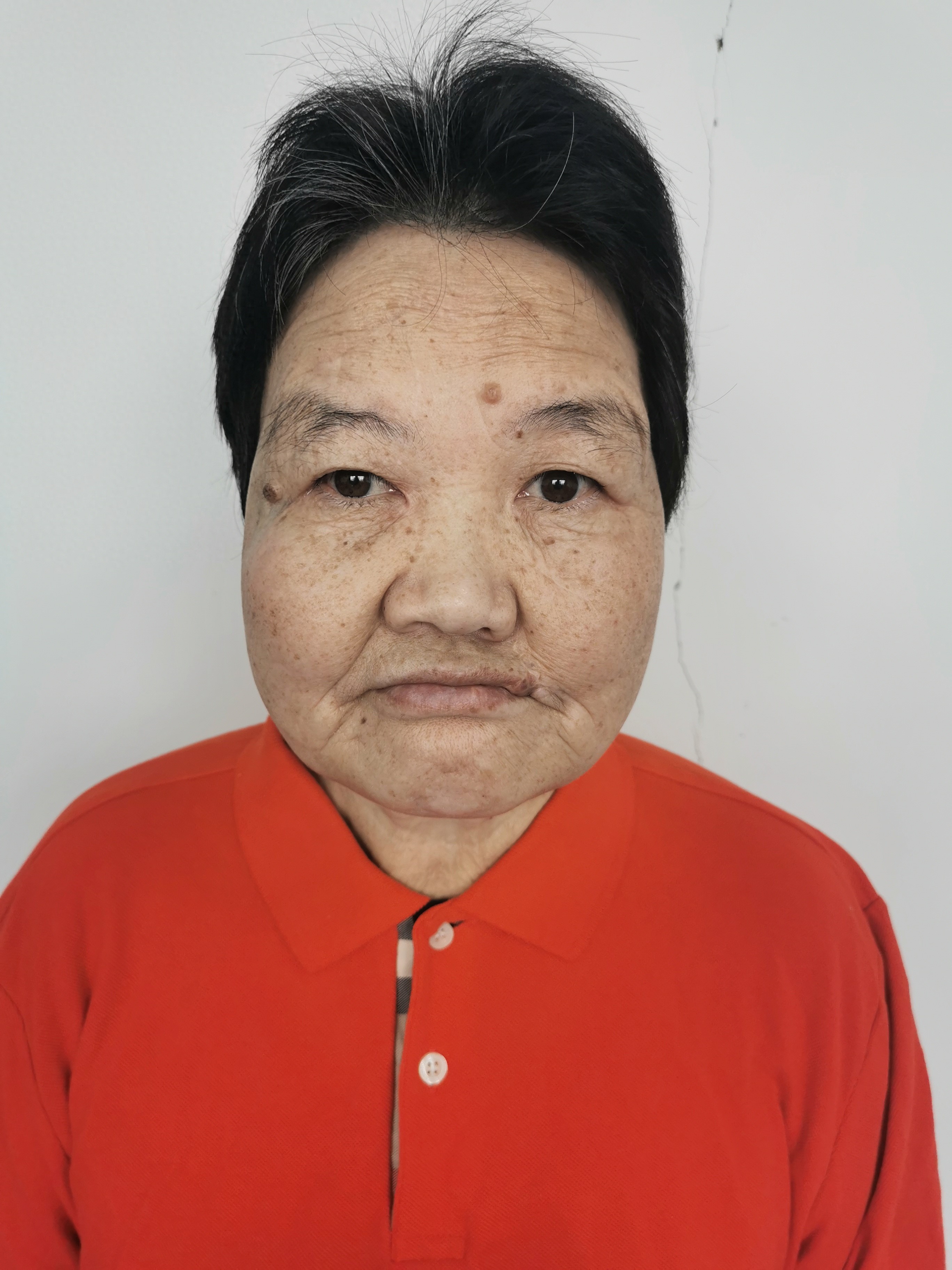 走失者照片 北京市寻亲：五旬女子被救助，高1米...