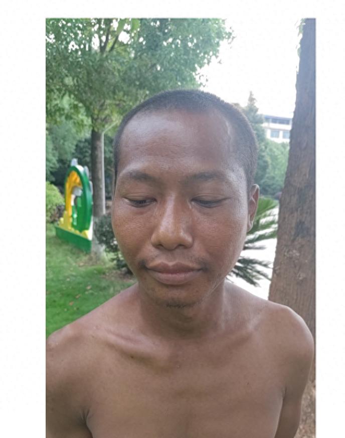 走失者照片 永州市寻亲：青年男子被救助，穿蓝色...